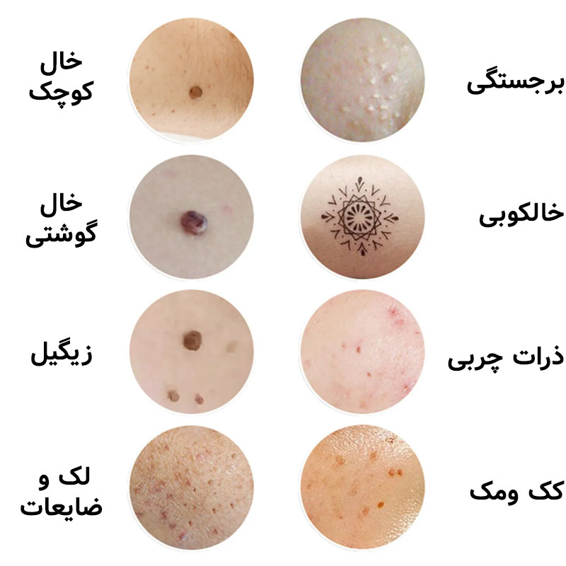 نحوه کارکرد با دستگاه پلاسما پن 9 قدرته Ophera